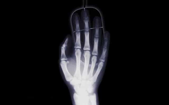 X-ray of a person's hand while using a mouse